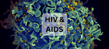 HIV & AIDS