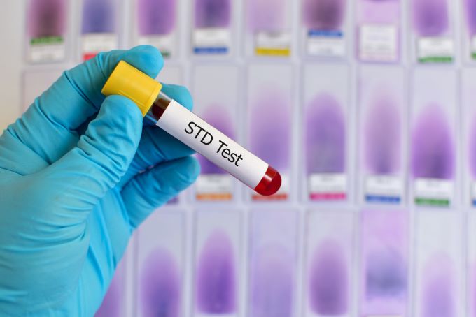 STD test